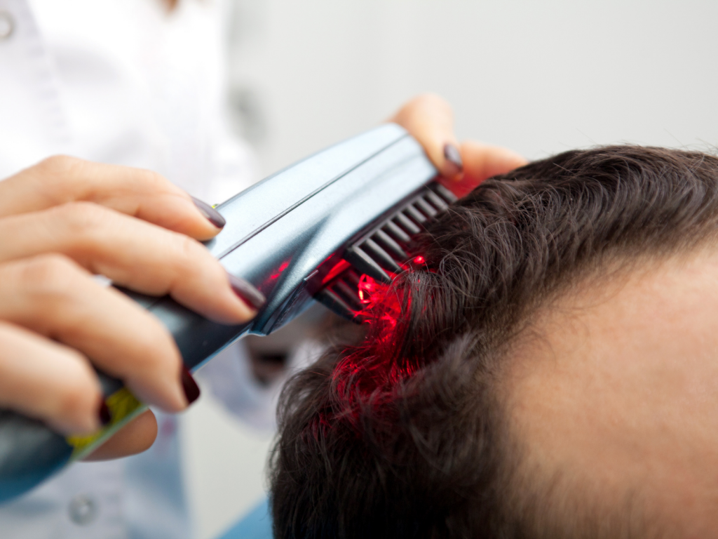terapia capilar com alta frequência, um procedimento da terapia capilar que utiliza dessa tecnologia no couro cabeludo.
